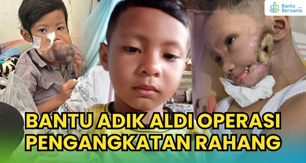 Bantu Aldi Jalani Operasi Pengangkatan Rahang Melawan Kanker Mulut