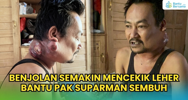 Benjolan Semakin Mencekik Leher, Bantu Pak Suparman Sembuh