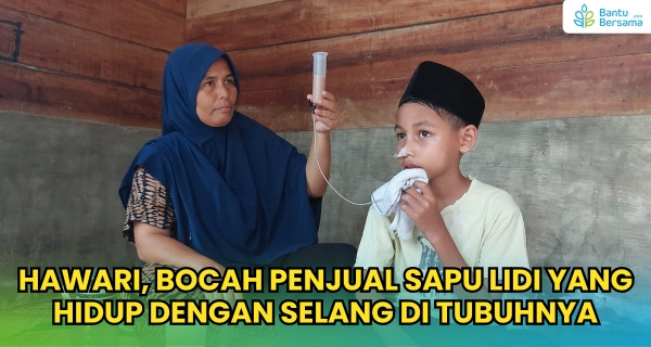 Hawari, Bocah Penjual Sapu Lidi Yang Hidup Dengan Selang Di Tubuhnya