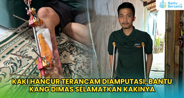 Kaki Hancur Terancam Diamputasi, Bantu Kang Dimas Selamatkan Kakinya