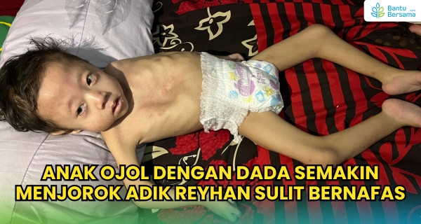 Napas Reyhan Kian Sesak, Anak Driver Ojol Butuh Pertolongan