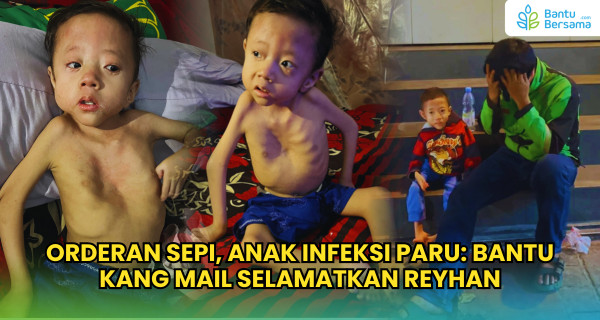 Orderan Sepi, Anak Infeksi Paru: Bantu Kang Mail Selamatkan Reyhan