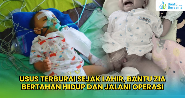 Usus Terburai Sejak Lahir, Bantu Zia Bertahan Hidup Dan Jalani Operasi