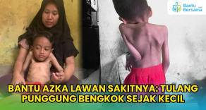Bantu Azka Lawan Sakitnya: Tulang Punggung Bengkok Sejak Kecil