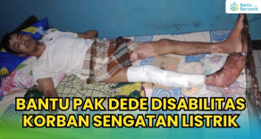 Pak Dede, Kuli Bangunan Kehilangan Kedua Tangan Akibat Sengatan Listrik