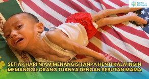 Tangis Niam Tiada Henti, Pejuang Kecil Lumpuh Otak Butuh Pertolongan